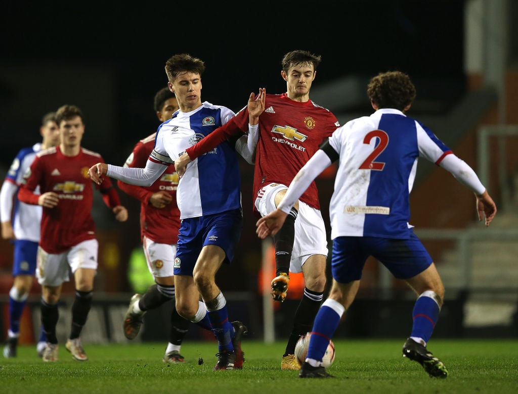 Blackburn u23 sales manchester city u23