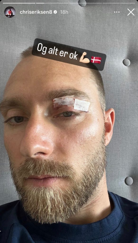 Christian Eriksen takes to Instagram to post injury photo