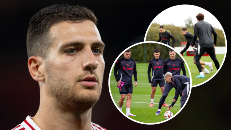 MANCHESTER, ENGLAND - SEPTEMBER 25: Diogo Dalot of Manchester United looks on during the UEFA Europa League 2024/25 League Phase MD1 match between ...